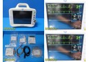 GE Dash 3000 Series Patient Monitor (SpO2 Nellcor) W/ NEW Patient Leads ~ 34753