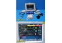 Philips MP30 (M8002A) Anesthesia Patient Monitor W/ MMS Module & Leads ~ 35211