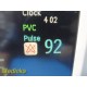 Philips Intellivue MP50 CRITICAL CARE Monitor W/ CO IBP MMS PRINT Modules~35181