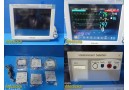 Philips MP70 (M8007A) Critical Care Monitor W/ MMS, PRINT Module & Leads ~ 35934