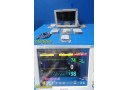Philips MP70 (M8007A) Neonatal Monitor W/ MMS, CO2, PRINT Module & Leads ~ 35929