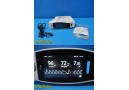 2016 Masimo Radical-7 Pulse CO-Oximeter Monitor W/ RDS-1 Dock & Sensor ~ 37160