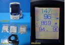 Welch Allyn 45NT0 Spot Vital Signs LXi Monitor W/ NEW Battery & New Leads ~38070