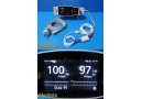 2017 Masimo Radical-7 Pulse CO-Oximeter W/ RDS-3 Dock, SpO₂ Sensor & Cable~38589