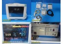 Philips MP50 Patient Monitor W/ CO2+MMS, Print, Press, Temp Module & Leads~38235