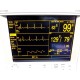 Datascope Passport XG Patient Monitor W/ New Leads (NBP EKG SpO2 T/Print )~12345