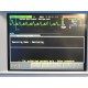 HP VIRIDIA 24C ANESTHESIA MONITOR (NBP ECG SpO2 CO / TEMP Print) W/ LEADS~14540