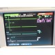 HP VIRIDIA 24C CRITICAL CARE MONITOR (STANDARD/DTM/BAM/CO/PRINT) W/ LEADS~14548