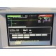 HP VIRIDIA 24C CRITICAL CARE MONITOR (STANDARD/ CO2 / CO / PRINT) W/ LEADS~14549