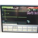 HP VIRIDIA 24C CRITICAL CARE MONITOR (STANDARD/ DTM / CO / PRINT) W/ LEADS~14550