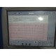 Philips Pagewriter Touch Cardiograph W/ Acquisition Module & New Battery~17089