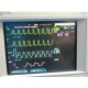 HP Viridia 24C Critical Care Multiparameter Patient Monitor W/ Some Leads ~14561