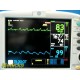 GE DASH 3000 / V5 Patient Monitor (IBP CO2 SpO2 ECG NBP Temp/CO) W/ leads~ 17452