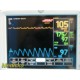 GE DASH 3000 Patient Monitor (CO2 SpO2 ECG NBP T/CO) & Leads ~ 17465