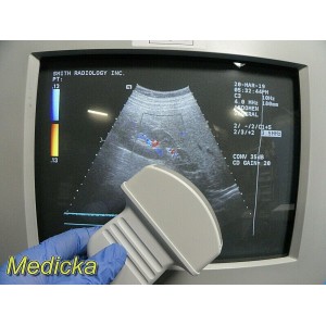 https://www.themedicka.com/6004-65015-thickbox/acuson-c3-needle-guide-convex-array-ultrasound-transducer-probe-16831.jpg