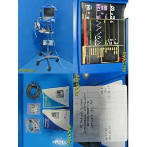 https://www.themedicka.com/7429-81438-thickbox/ge-dinamap-pro-1000-dp1100-patient-monitor-w-new-leadsuser-manual-stand18749.jpg