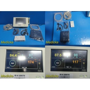 https://www.themedicka.com/8211-90490-thickbox/2012-spacelabs-ultraview-dm3-spot-monitor-w-patient-leads-adapterthermo20071.jpg