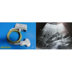 https://www.themedicka.com/9191-101813-thickbox/acuson-6c2-convex-ultrasound-transducer-probe-22580.jpg