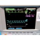 HP Viridia 24 Critical Care System Patient Monitor W/ Rack Modules & Leads~14028